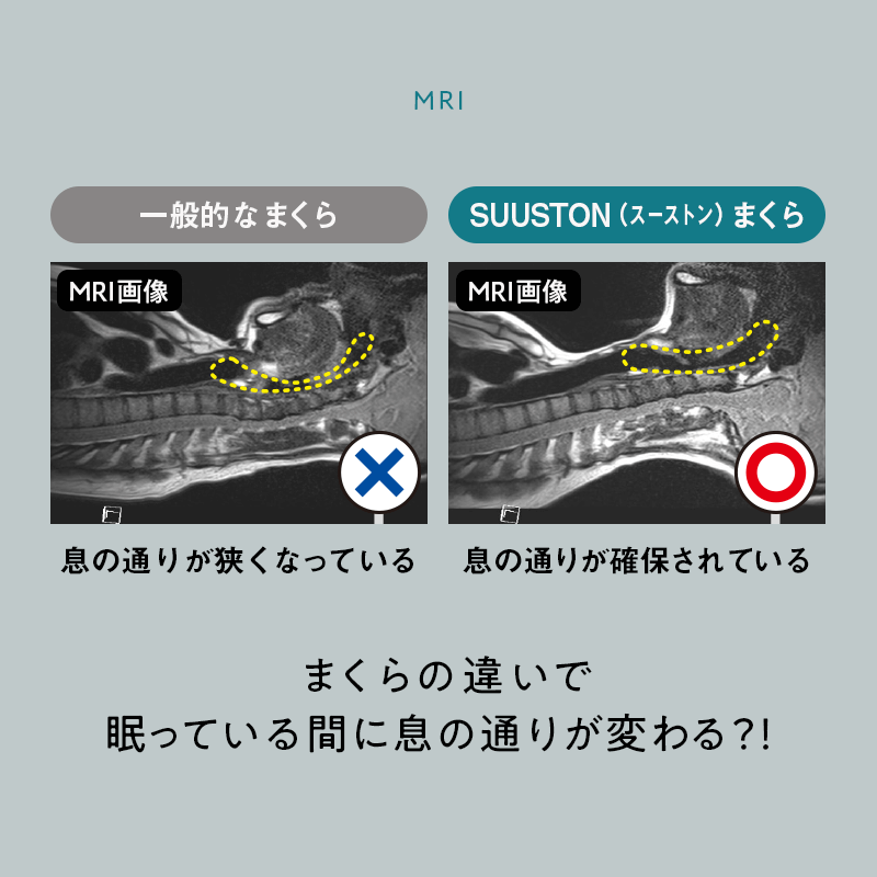 ※3月16日順次発送【エスメラルダ】大人用まくら｜深い呼吸で深く眠れる【スーストン枕】睡眠中の気道を確保する構造｜14日間返金保証付