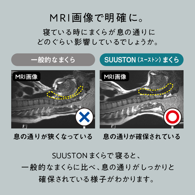 ※3月16日順次発送【エスメラルダ】大人用まくら｜深い呼吸で深く眠れる【スーストン枕】睡眠中の気道を確保する構造｜14日間返金保証付